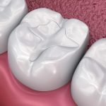 مواد ترمیمی دندانپزشکی